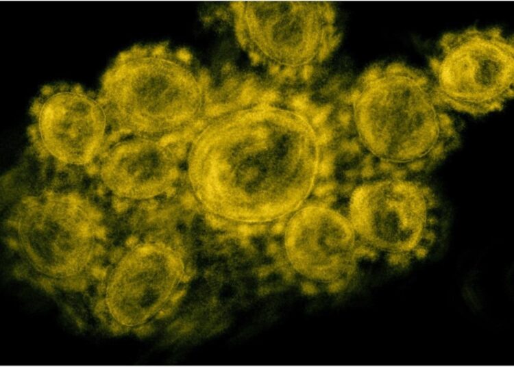 Study: Low expression of EXOSC2 protects against clinical COVID-19 and impedes SARS-CoV-2 replication. Image Credit: NIAID
