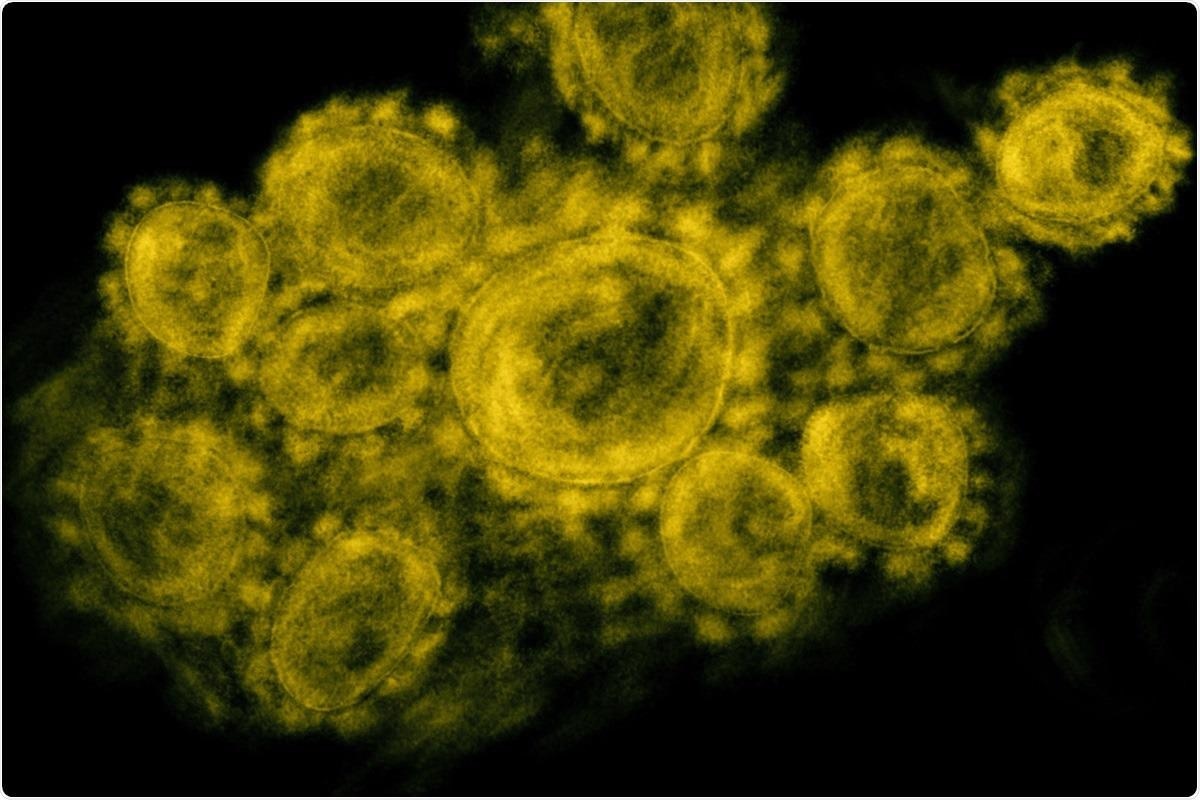 Study: Low expression of EXOSC2 protects against clinical COVID-19 and impedes SARS-CoV-2 replication. Image Credit: NIAID