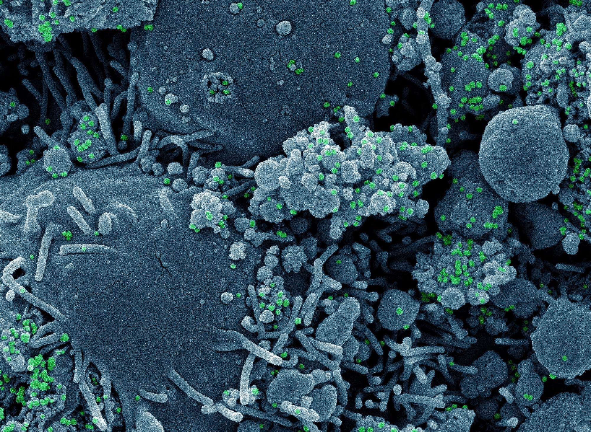 ​​​​​​​Study: Crystal structures and fragment screening of SARS-CoV-2 NSP14 reveal details of exoribonuclease activation and mRNA capping and provide starting points for antiviral drug development. ​​​​​​​Image Credit: NIAID