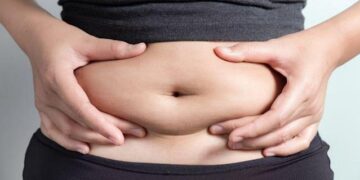 Abdominoplastie ratée