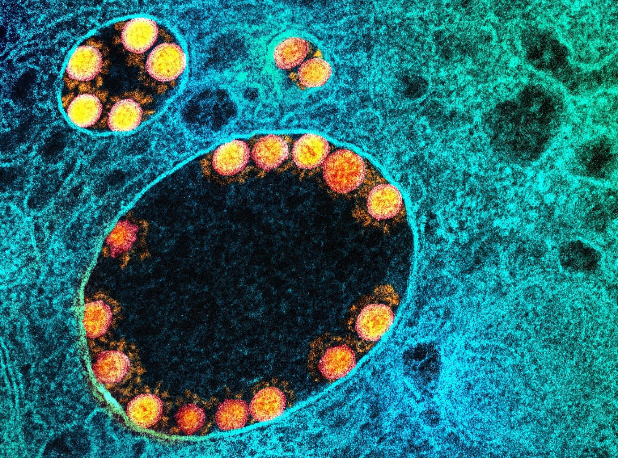 Study: SARS-CoV-2 Omicron neutralization and risk of infection among elderly after a booster dose of Pfizer vaccine. ​​​​​​​Image Credit: NIAID