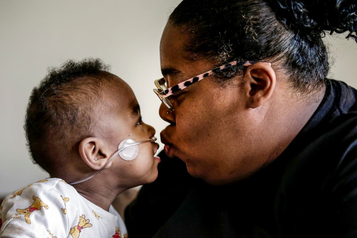 Les bébés les plus petits : repousser les limites de la vie plus tôt