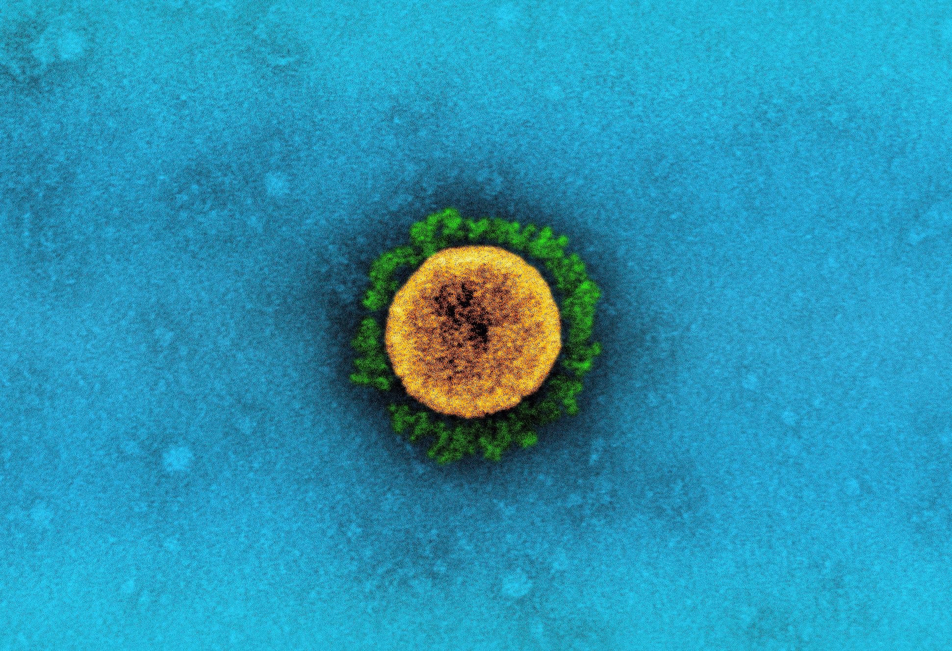 Study: Predictive value of reactogenicity for anti-SARS-CoV-2 antibody response in mRNA-1273 recipients: a multicenter prospective cohort study. Image Credit: NIAID