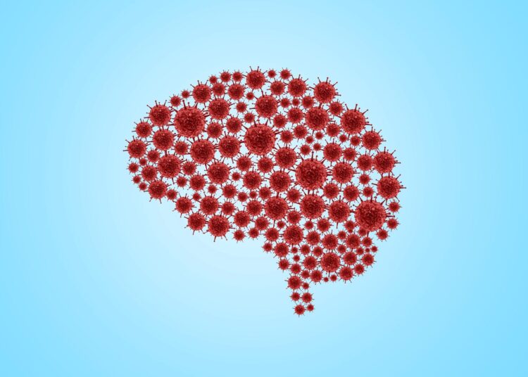 Study: Decreased cerebral blood flow in non-hospitalized adults who self-isolated due to COVID-19. Image Credit: DOERS / Shutterstock