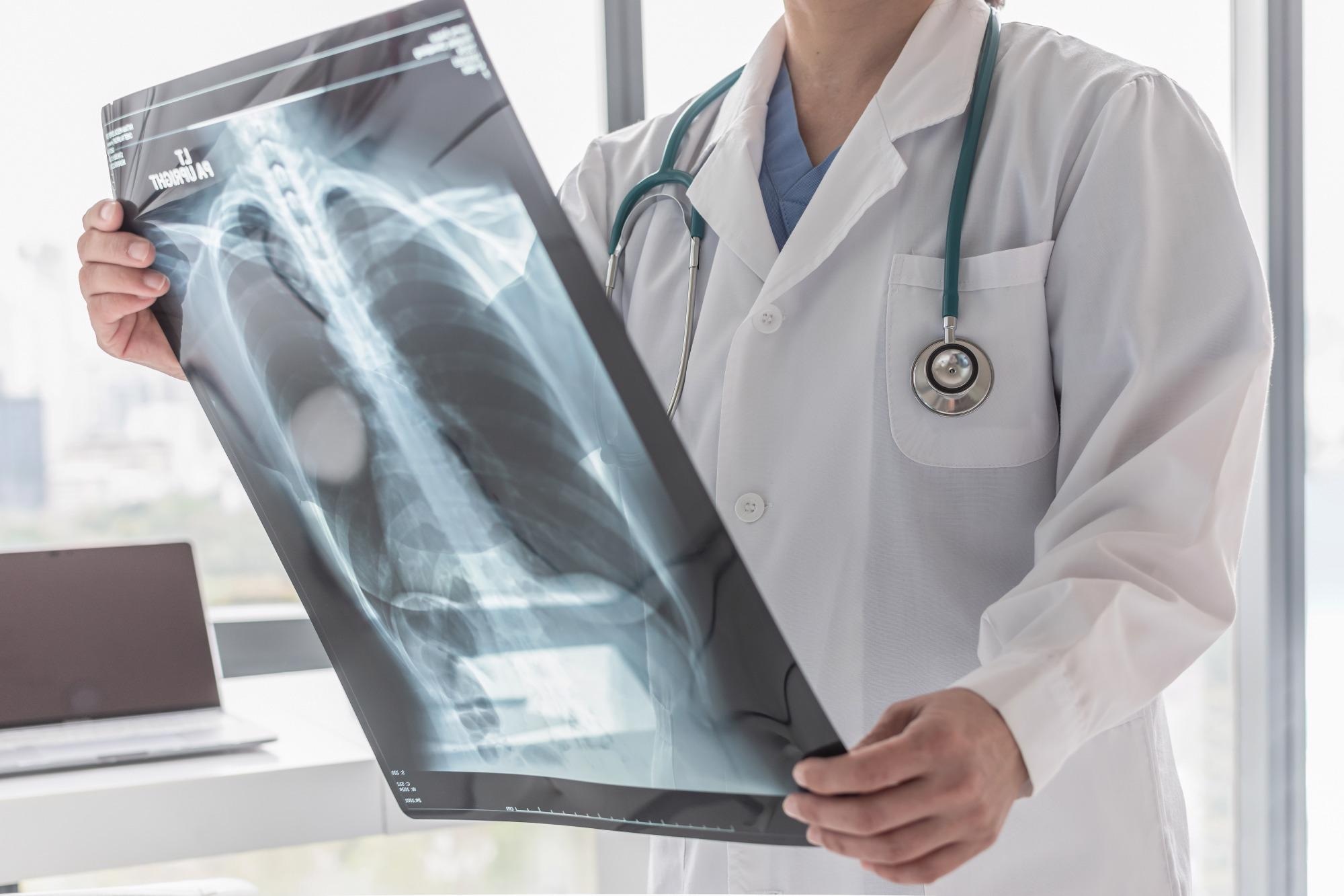 Study: Multi-omic comparative analysis of COVID-19 and bacterial sepsis-induced ARDS. Image Credit: Chinnapong / Shutterstock