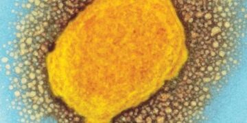 FIND pour présenter un aperçu de l'état de la surveillance des maladies et des diagnostics pour lutter contre le monkeypox