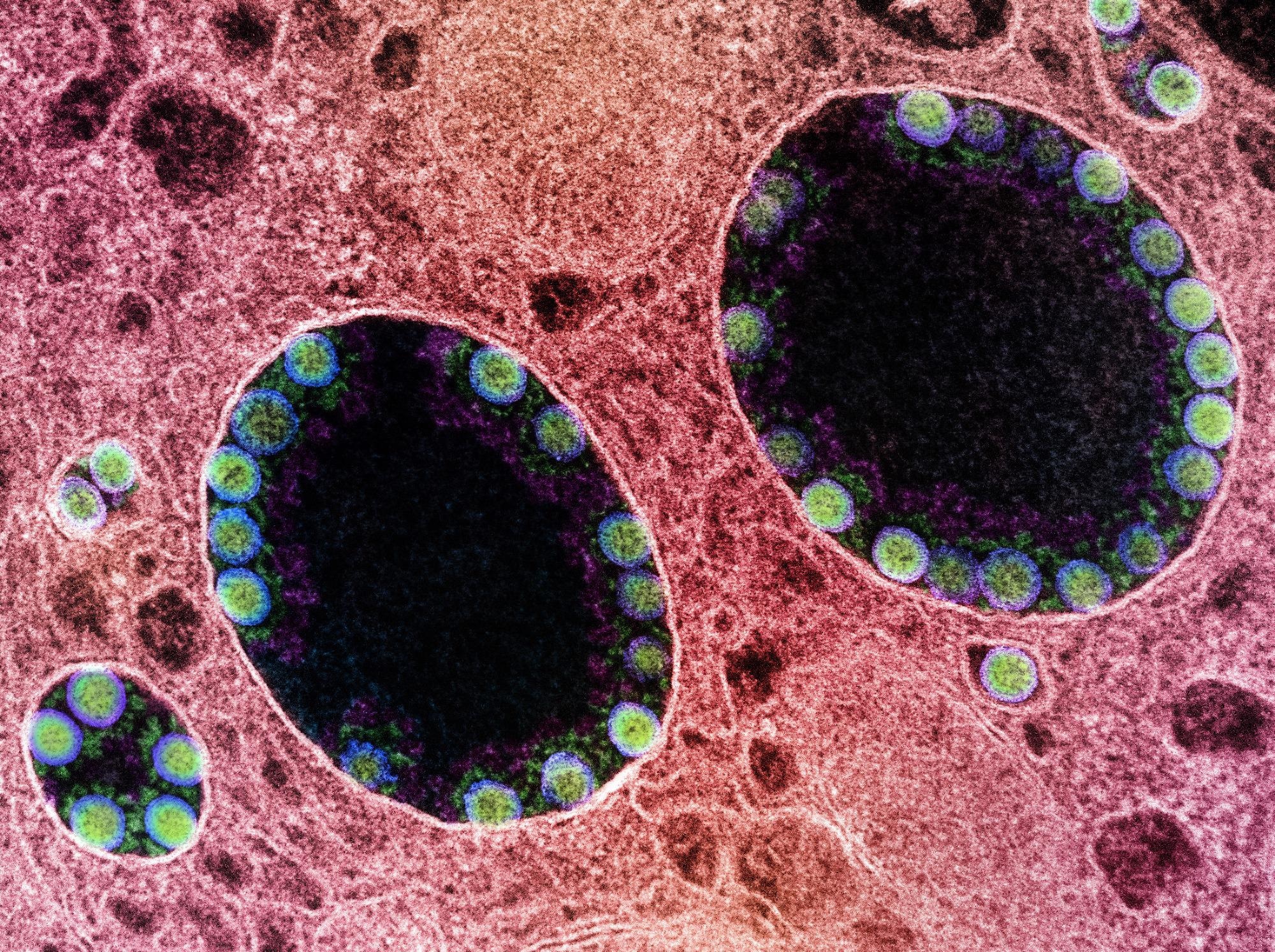 Study: Neutralization Escape by the SARS-CoV-2 Omicron Variants BA.2.12.1 and BA.4/BA.5. Image Credit: NIAID