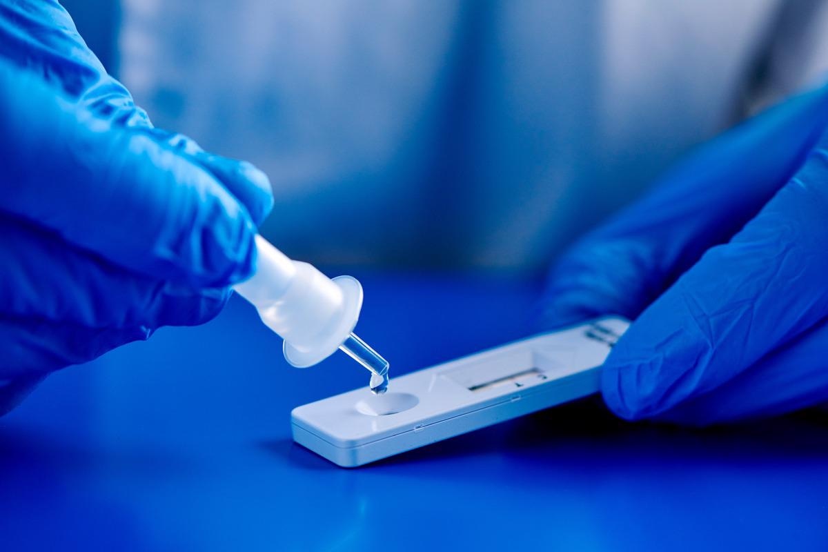 Study: Deep mutational scanning identifies SARS-CoV-2 Nucleocapsid escape mutations of currently available rapid antigen tests. Image Credit: nito/Shutterstock