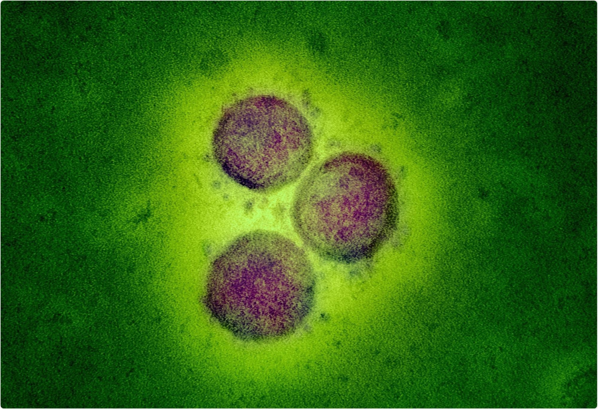 Study: Incidence and clinical phenotype of multisystem inflammatory syndrome in children after infection with the SARS-CoV-2 delta variant by vaccination status: a Danish nationwide prospective cohort study. Image Credit: NIAID