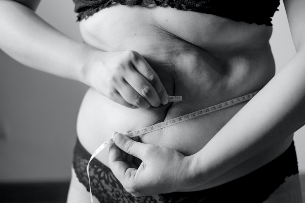 Activités physiques adaptées à l’obésité