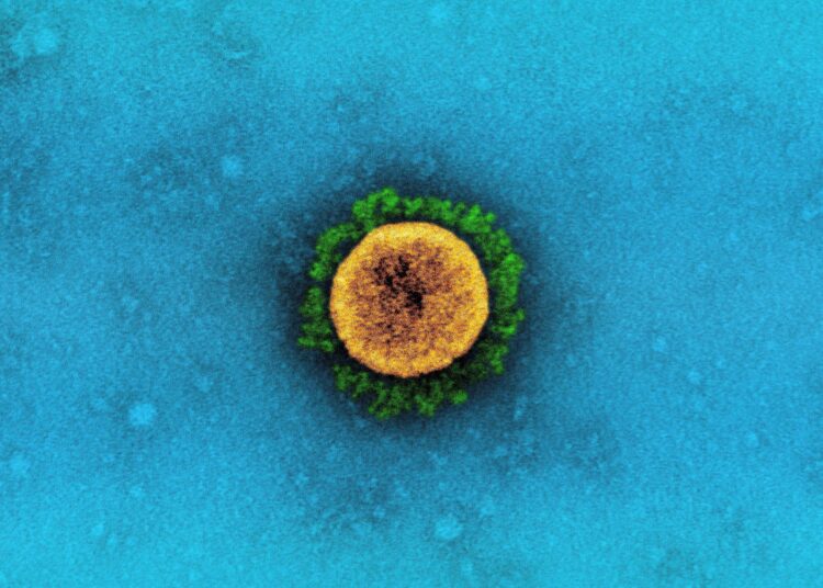 Study: Characterization of entry pathways, species-specific ACE2 residues determining entry, and antibody neutralization evasion of Omicron BA.1, BA.1.1, BA.2, and BA.3 variants Image Credit: NIAID
