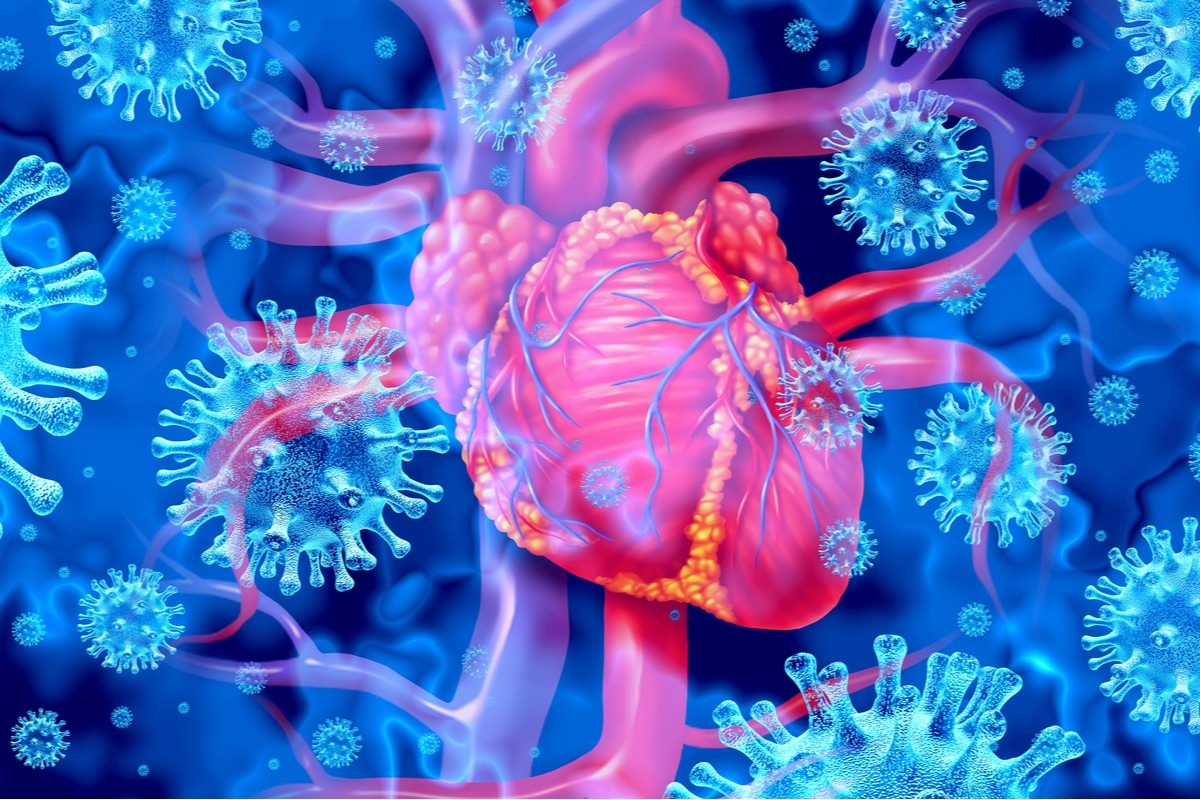 Study: Identification of critical genes and molecular pathways in COVID-19 myocarditis and constructing gene regulatory networks by bioinformatic analysis. Image Credit: Lightspring/Shutterstock