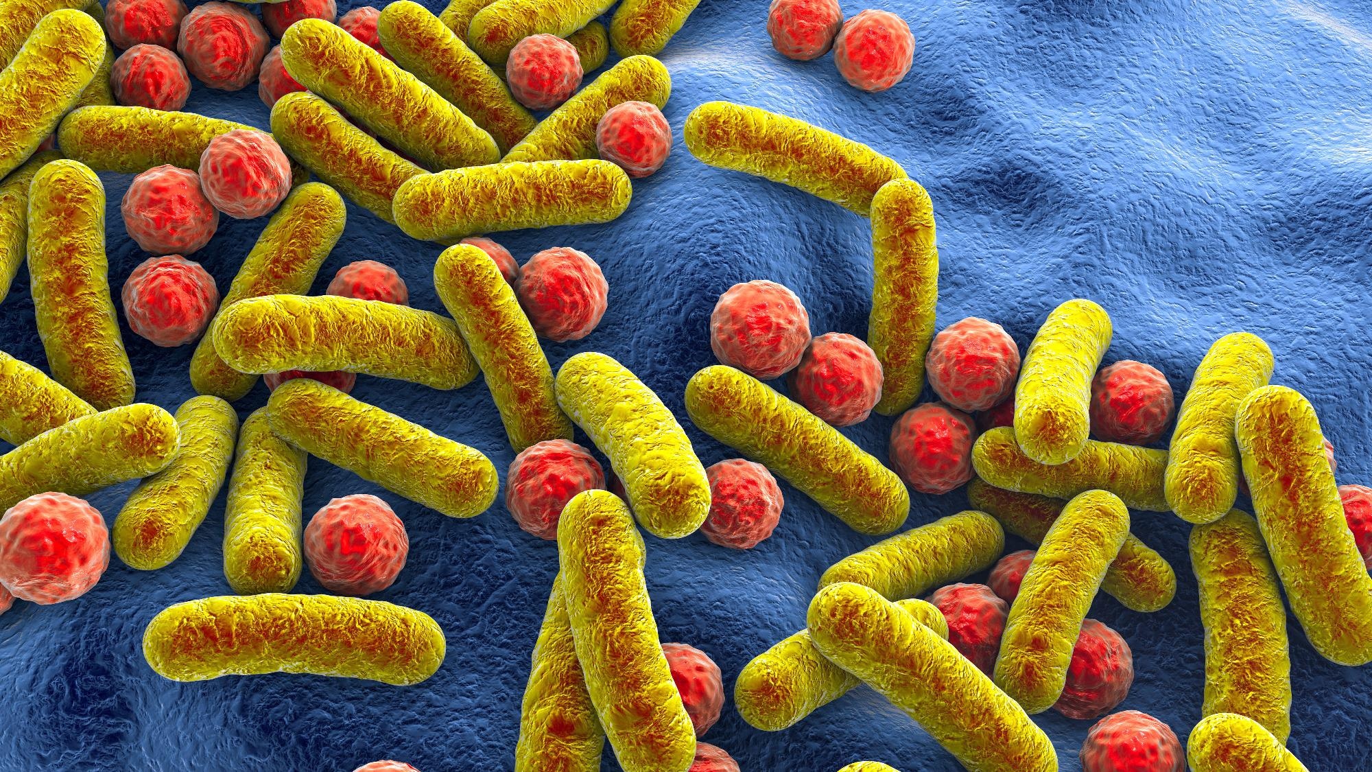 Study: The salivary and nasopharyngeal microbiomes are associated with SARS-CoV-2 infection and disease severity. Image Credit: Kateryna Kon / Shutterstock