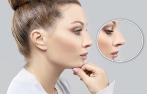 Rhinoplastie ultrasonique à Marseille