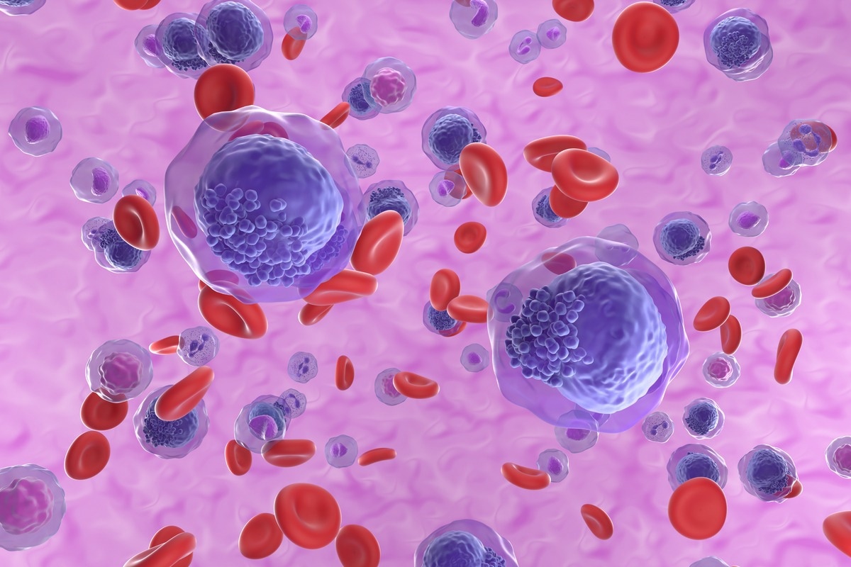 Crédit d'image : Nemes Laszlo/Shutterstock