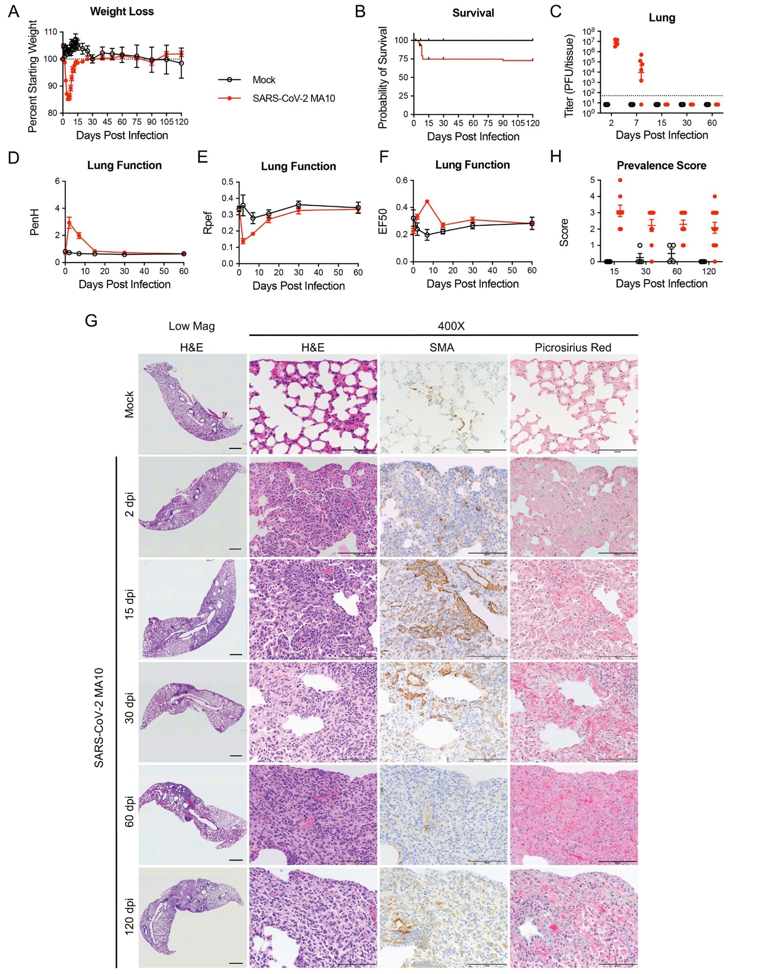 L'infection par le SRAS-CoV-2 MA10 provoque des lésions pulmonaires chez les souris âgées survivantes.  Des souris BALB/c femelles âgées d'un an ont été infectées par 103 PFU SARS-CoV-2 MA10 (n = 74) ou PBS (n = 24) et surveillées pour (A) le pourcentage de poids de départ et (B) la survie.  (C) Les titres pulmonaires de virus infectieux log transformés ont été dosés aux points de temps indiqués.  La ligne pointillée représente LOD.  Les échantillons non détectés sont tracés à la moitié de la LOD.  (D à F) La fonction pulmonaire a été évaluée par pléthysmographie du corps entier pour (D) PenH, (E) Rpef et (F) EF50.  (G) L'analyse histopathologique des poumons aux moments indiqués est indiquée.  H&E indique une coloration à l'hématoxyline et à l'éosine.  SMA indique l'immunohistochimie de marquage DAB (marron) pour l'actine musculaire lisse α.  La coloration Picrosirius Red (rose-rouge vif) met en évidence les fibres de collagène.  Les barres d'échelle d'image représentent 1000 μm pour un faible grossissement et 100 μm pour les images 400X.  (H) Le score d'incidence de la maladie est indiqué pour les points temporels indiqués : 0 = 0 % de la surface totale de la section examinée, 1 = moins de 5 % ;  2 = 6 à 10 % ;  3 = 11 à 50 % ;  4 = 51 à 95 % ;  5 = supérieur à 95 %.  Les graphiques représentent les individus autopsiés à chaque point de temps (C et H), avec la valeur moyenne pour chaque traitement et les barres d'erreur représentant l'erreur standard de la moyenne.  Les animaux infectés simulés sont représentés par des cercles noirs ouverts et les animaux infectés par le SARS-CoV-2 MA10 sont représentés par des cercles rouges fermés.