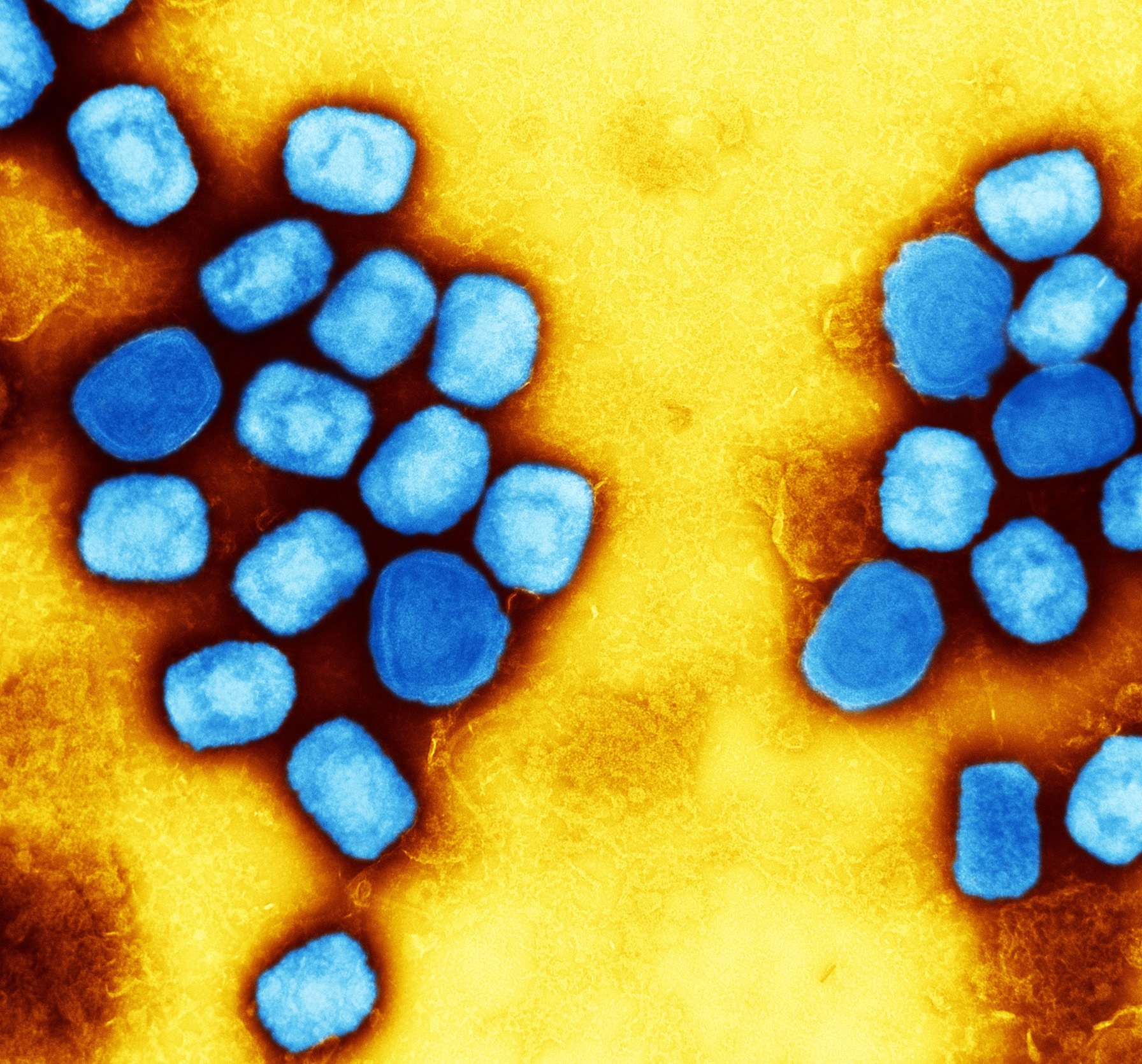 Study: Demographic and clinical characteristics of confirmed human monkeypox virus cases in individuals attending a sexual health centre in London, UK: an observational analysis. Image Credit: NIAID