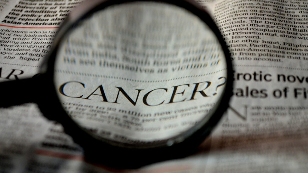 3 types de traitements contre le cancer de la prostate