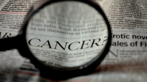 3 types de traitements contre le cancer de la prostate