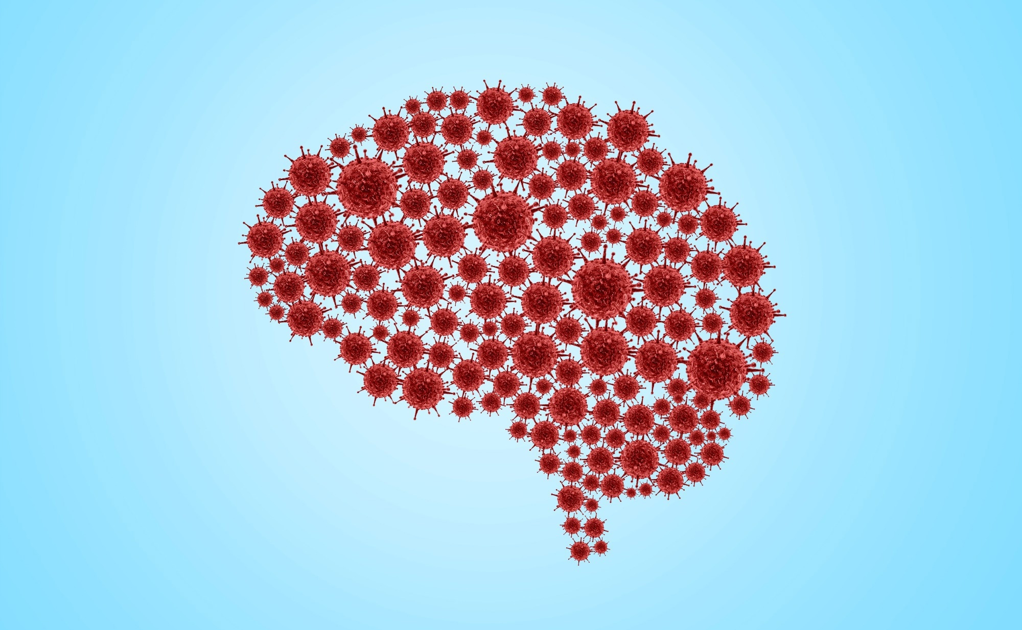 Study: Neurovascular injury with complement activation and inflammation in COVID-19. Image Credit: DOERS / Shutterstock