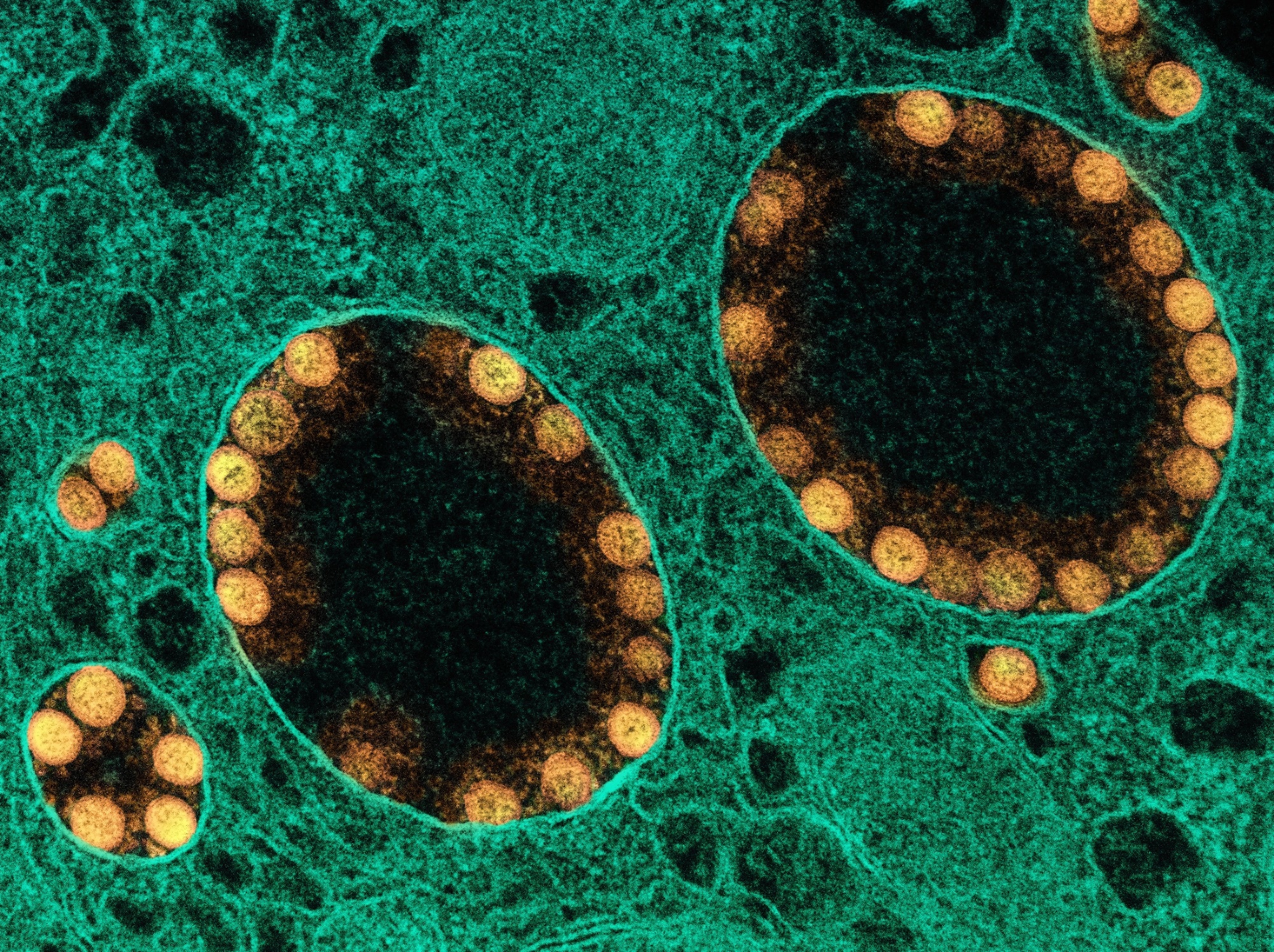 Study: Discovery and structural characterization of chicoric acid as a SARS-CoV-2 nucleocapsid protein ligand and RNA binding disruptor. Image Credit: NIAID