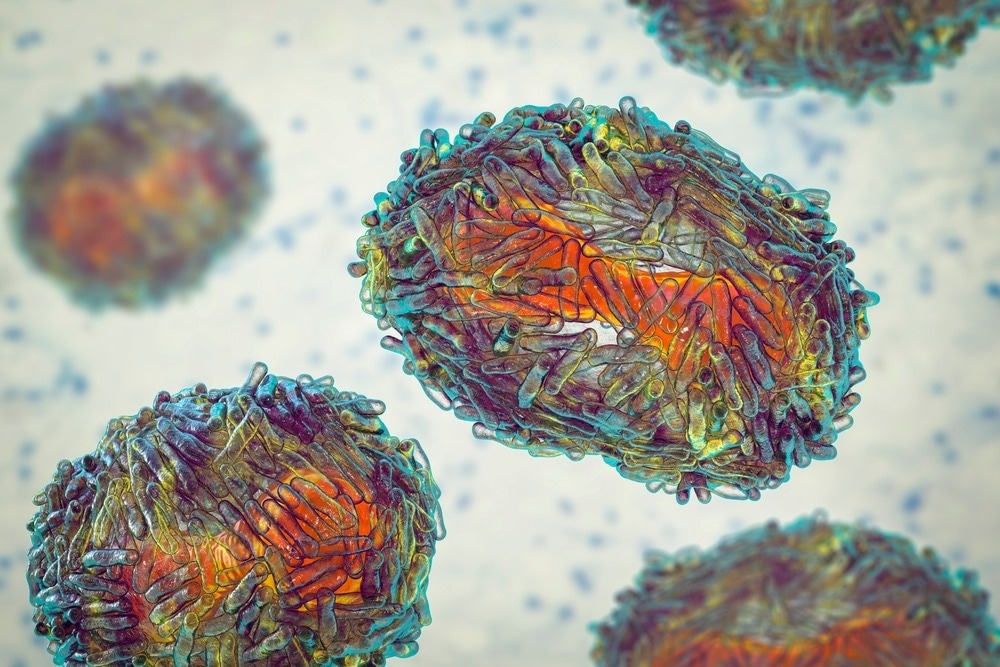 Study: Monkeypox: A New Threat? Image Credit: Kateryna Kon / Shutterstock.com