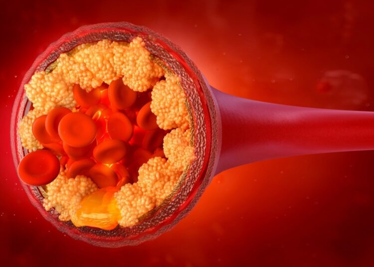 Study: LDL Cholesterol—How Low Can We Go? Image Credit: Corona Borealis Studio/Shutterstock