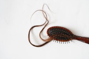Quelles sont les techniques récentes de greffe capillaire ?