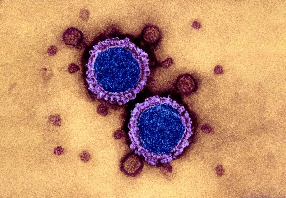 Study: Fc effector activity and neutralization against SARS-CoV-2 BA.4 is compromised in convalescent sera, regardless of the infecting variant. Image Credit: CI Photos / Shutterstock.com