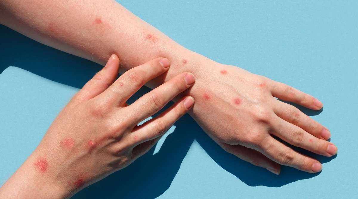 Study: Unusual global outbreak of monkeypox: what should we do? Image Credit: Marina Demidiuk/Shutterstock