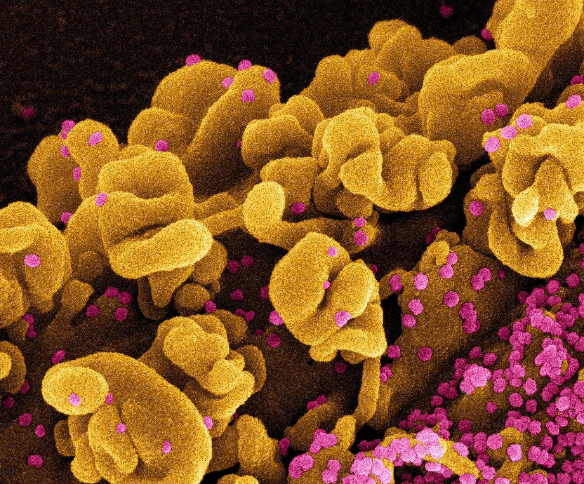 Study: Sensitive detection of SARS-CoV-2 on paper. Image Credit: NIAID