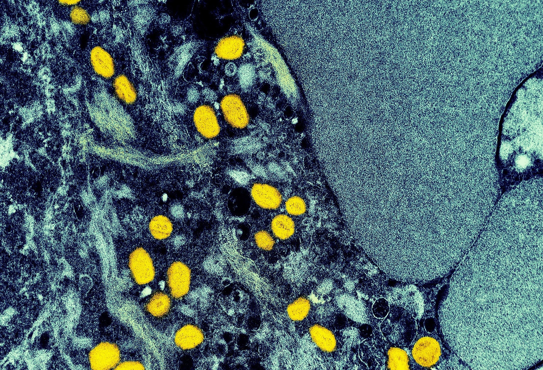 Study: A new and efficient enrichment method for metagenomic sequencing of monkeypox virus Image Credit: NIAID