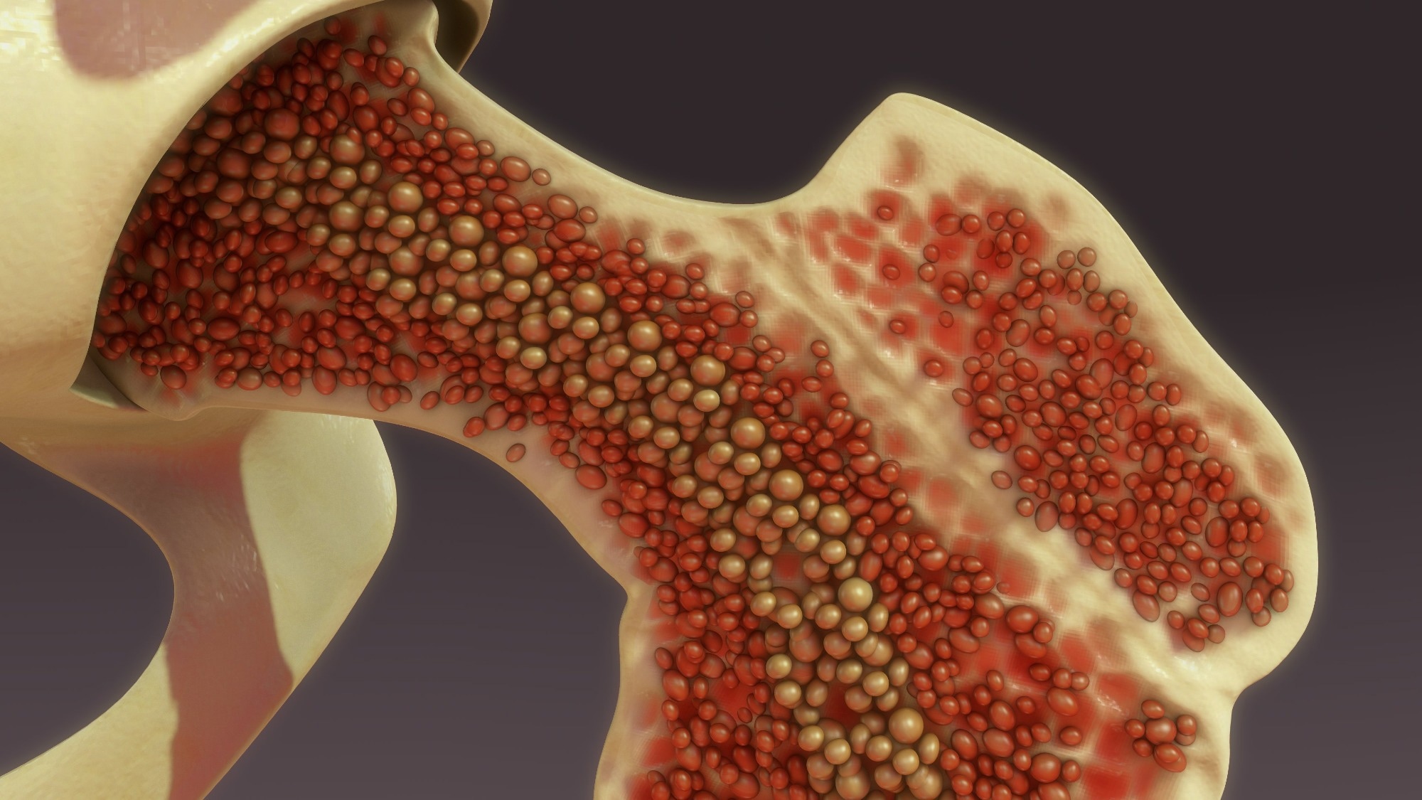 Study: SARS-CoV-2 specific plasma cells acquire the phenotype of long-lived plasma cells in the human bone marrow. Image Credit: sciencepics/Shutterstock