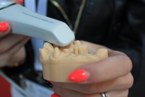 Comment cacher sa calvitie ?