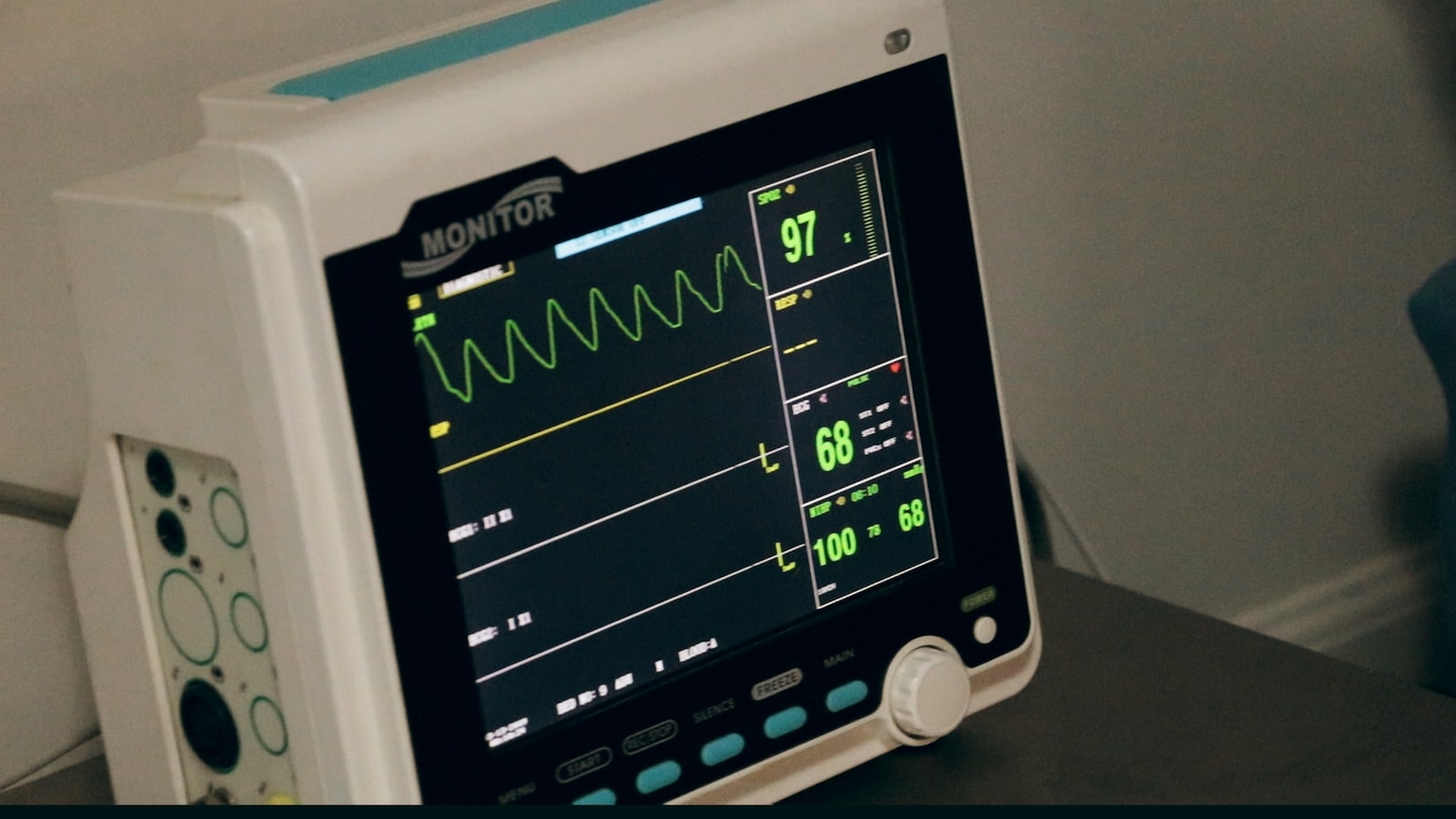 Traitement de l’AVC : comment procéder ?
