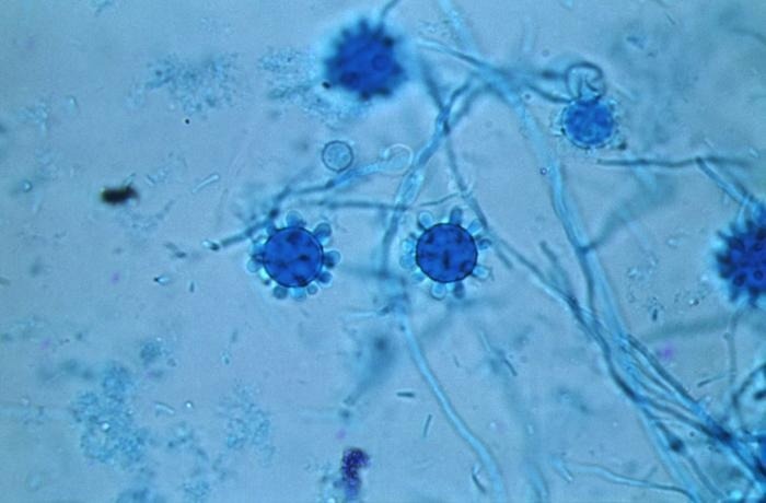 Sous un grossissement de 800X, cette photomicrographie a révélé certains des détails ultrastructuraux présentés par les organismes fongiques Histoplasma capsulatum, qui avaient été extraits d'un isolat jamaïcain qui comprenait un certain nombre de macroconidies tuberculées, sphéroïdales et d'hyphes filamenteux diaphanes.