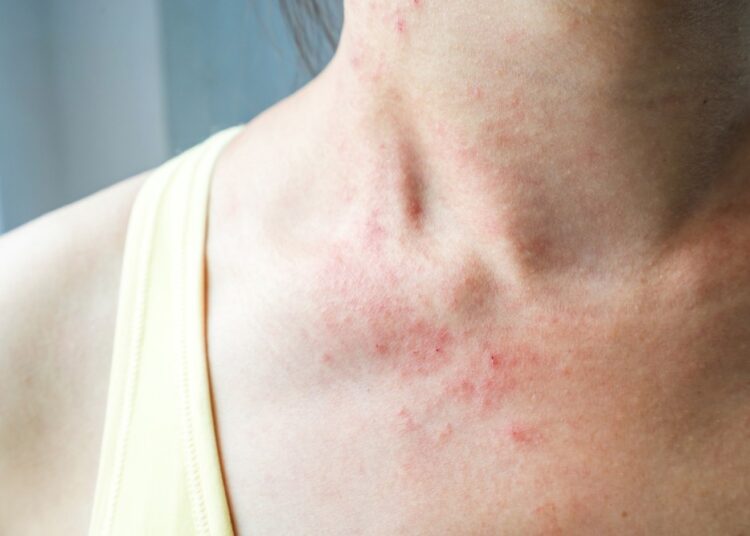 Study: SARS-CoV-2 and Skin: New Insights and Perspectives. Image Credit: kitzcorner/Shutterstock