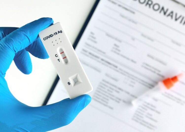 Study: Deep mutational scanning identifies SARS-CoV-2 Nucleocapsid escape mutations of currently available rapid antigen tests. Image Credit: eakasarn/Shutterstock
