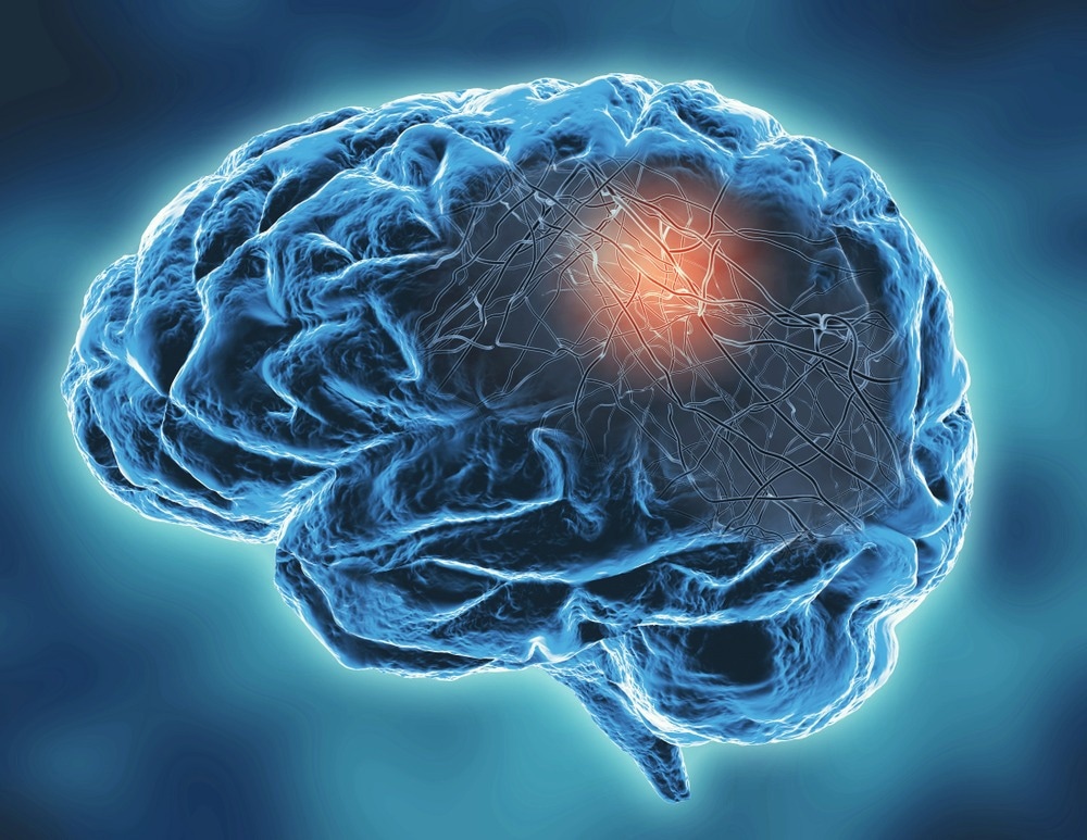 Study: Trans-synaptic dwelling of SARS-CoV-2 particles perturbs neural synapse organization and function. Image Credit: Illustration Forest/Shutterstock