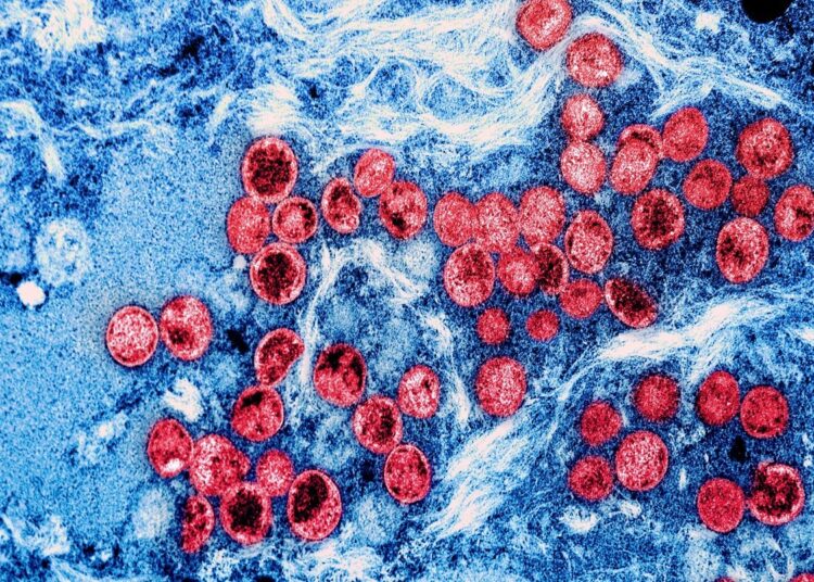 Study: Genome characterization of monkeypox cases detected in India: Identification of three sub clusters among A.2 lineage. Image Credit: NIAID