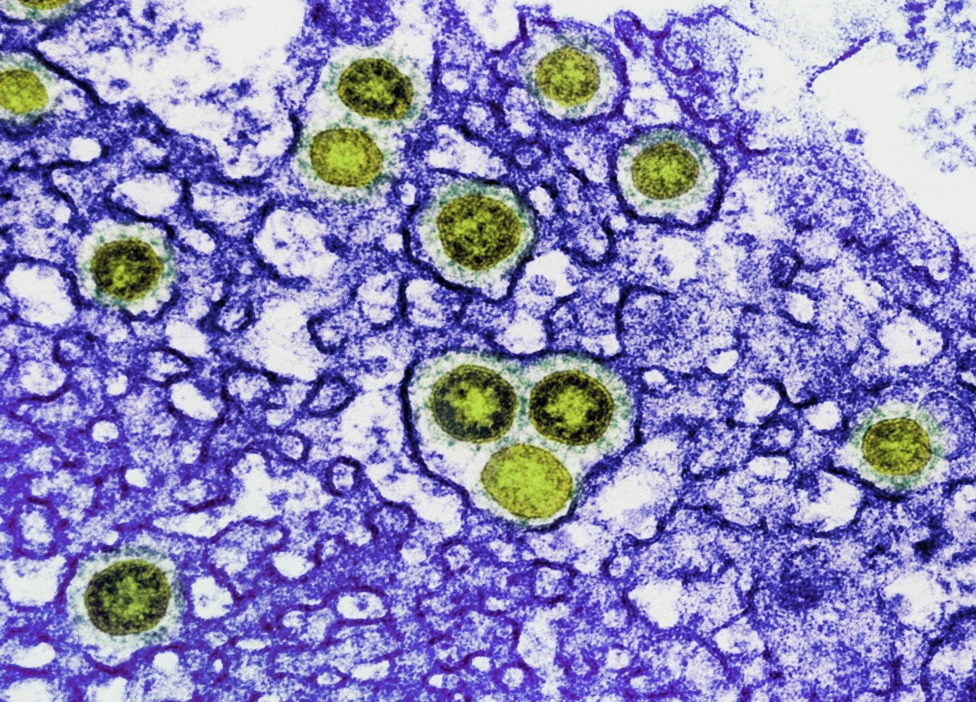 Combined Molnupiravir and Nirmatrelvir Treatment Improves the Inhibitory Effect on SARS-CoV-2 in Rhesus Macaques. Image Credit: NIAID