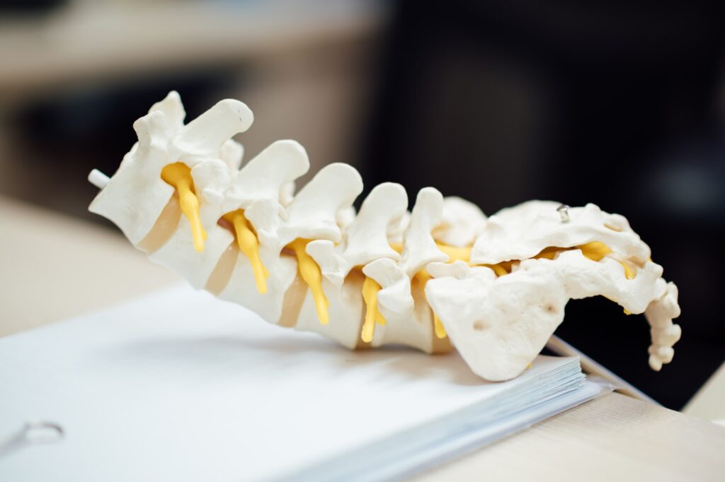 Ce que vous devez savoir sur la chirurgie de la colonne vertébrale