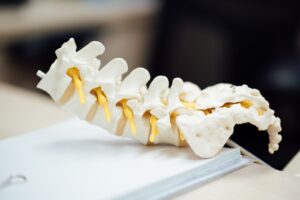 Ce que vous devez savoir sur la chirurgie de la colonne vertébrale