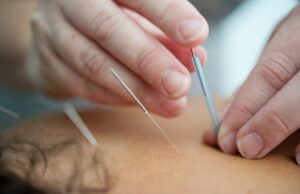 Qu’est-ce que la médecine traditionnelle chinoise ?