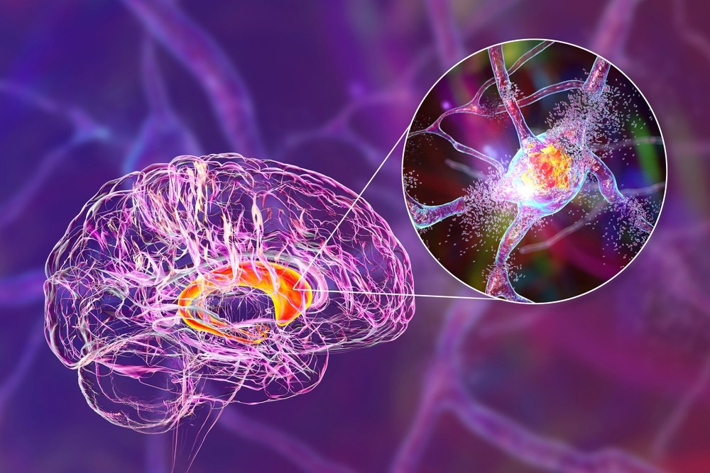 Explorer de nouvelles cibles thérapeutiques et biomarqueurs pour les maladies neurodégénératives