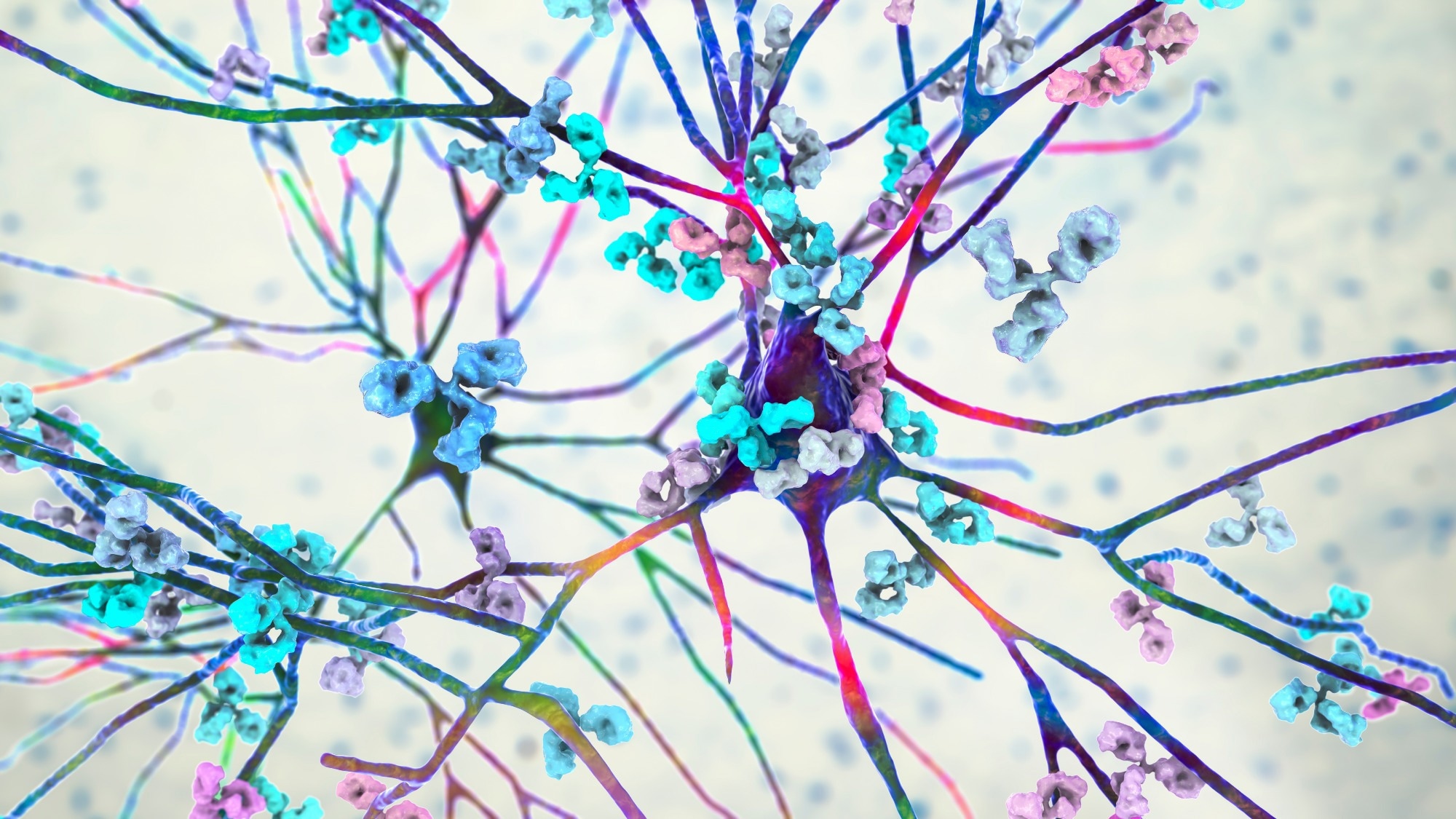 Study: Research progress of single-cell transcriptome sequencing in autoimmune diseases and autoinflammatory disease: A review. Image Credit: Kateryna Kon/Shutterstock