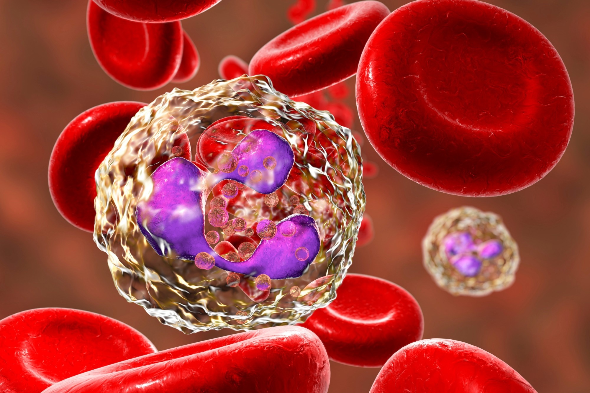 Study: Phenotypic alteration of low-density granulocytes in people with pulmonary post-acute sequalae of SARS-CoV-2 infection. Image Credit: Kateryna Kon / Shutterstock