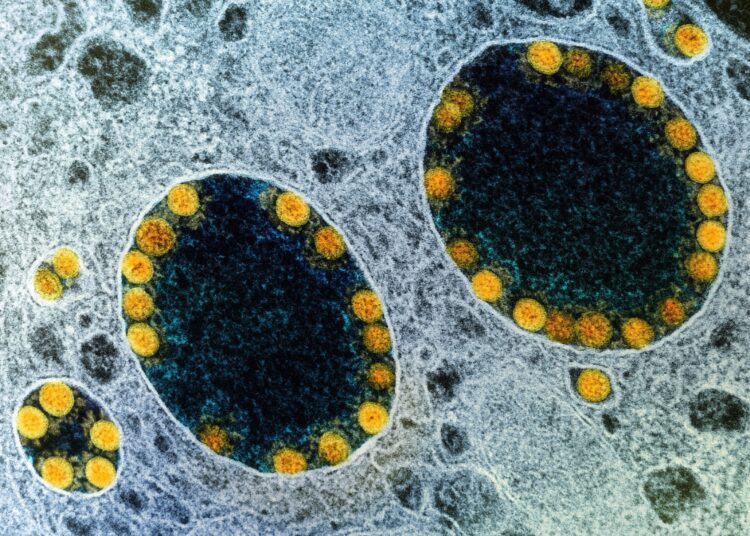 Study: Human induced pluripotent stem cell-derived salivary gland organoids model SARS-CoV-2 infection and replication. Image Credit: NIAID