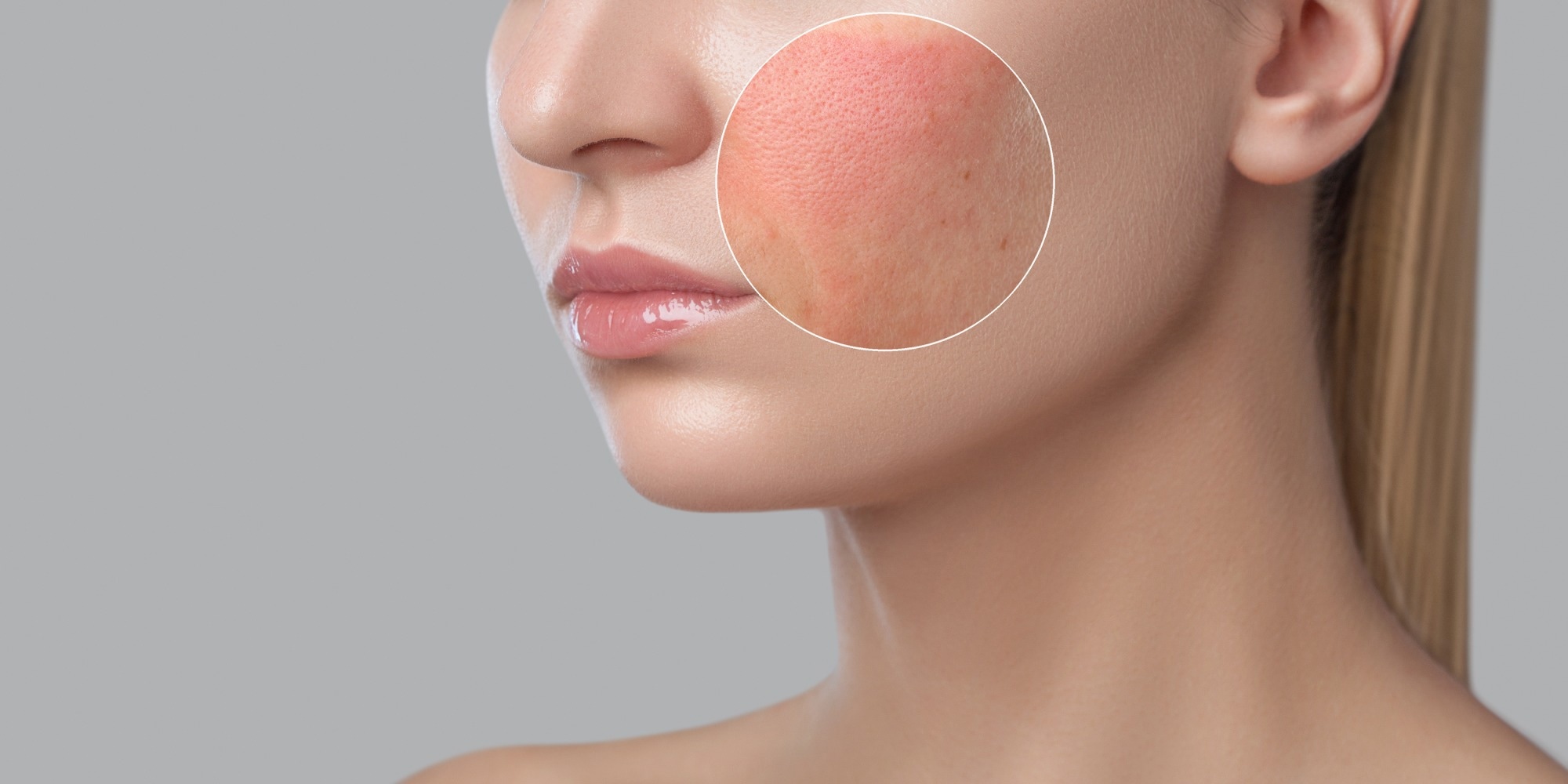 Study: Inflammation Causes Exacerbation of COVID-19: How about Skin Inflammation? Image Credit: dimid_86/Shutterstock