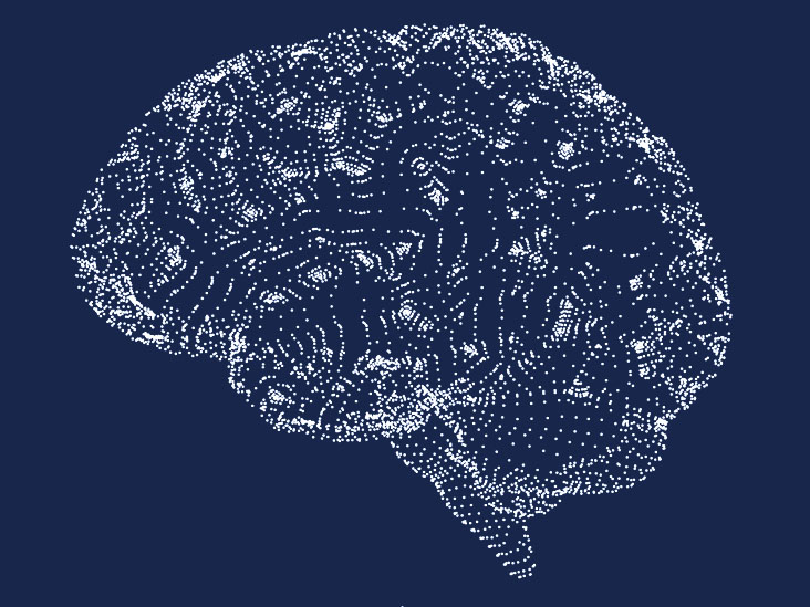 L'obésité a-t-elle plus à voir avec le cerveau qu'on ne le pensait au départ ?
